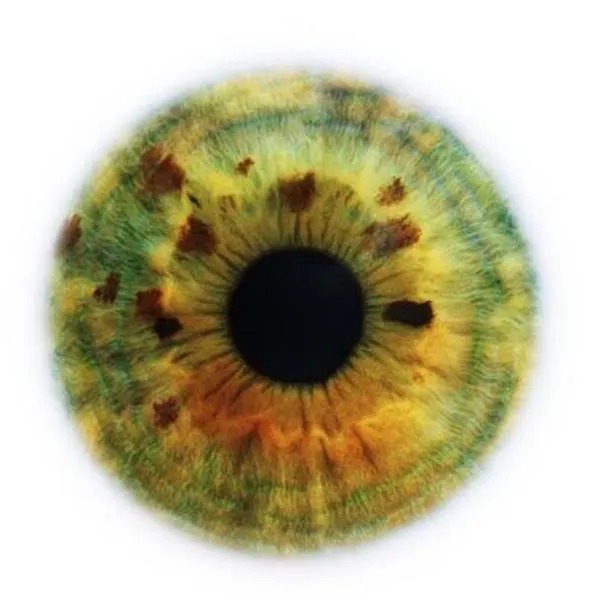 eye_greenbrownfleck.jpg